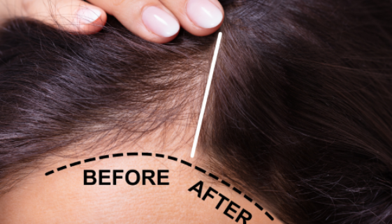 The Blonde Effect-46