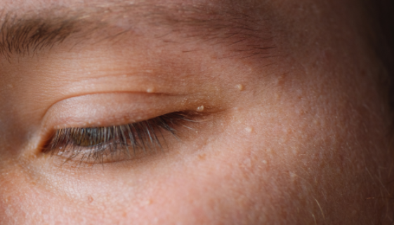 The Blonde Effect-59